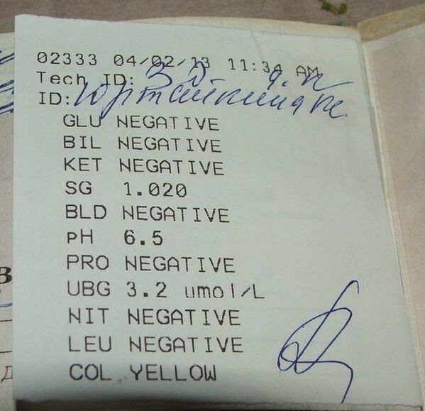 Results of my urine analysis before femixel